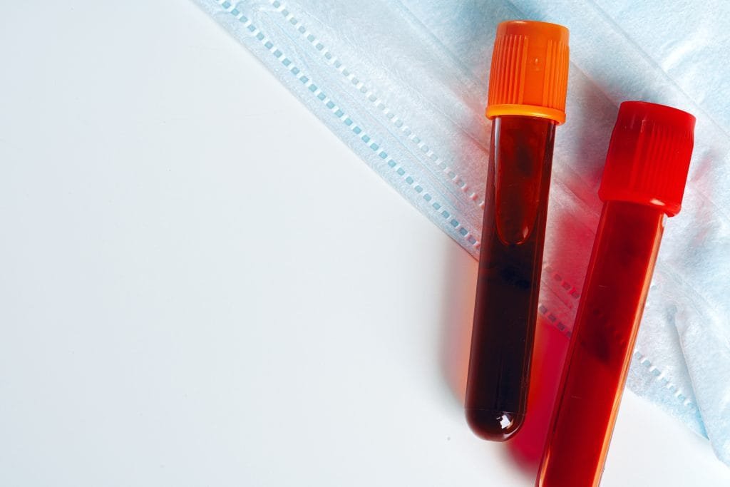 Close up of blood test tube with blood